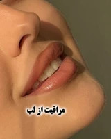 مراقبت از لب